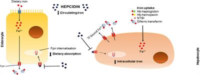 Pulmonary Arterial Hypertension: Iron Matters